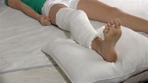 kırık bacak ne kadar sürede iyileşir